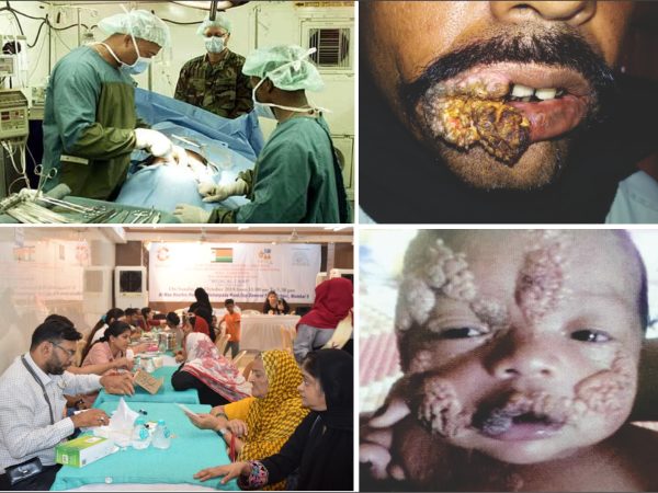 Medical Help for Poor and Sick